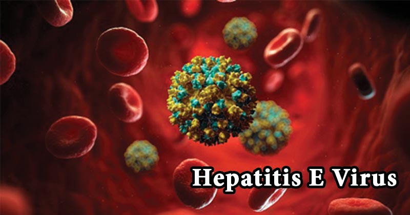 E型肝炎病毒