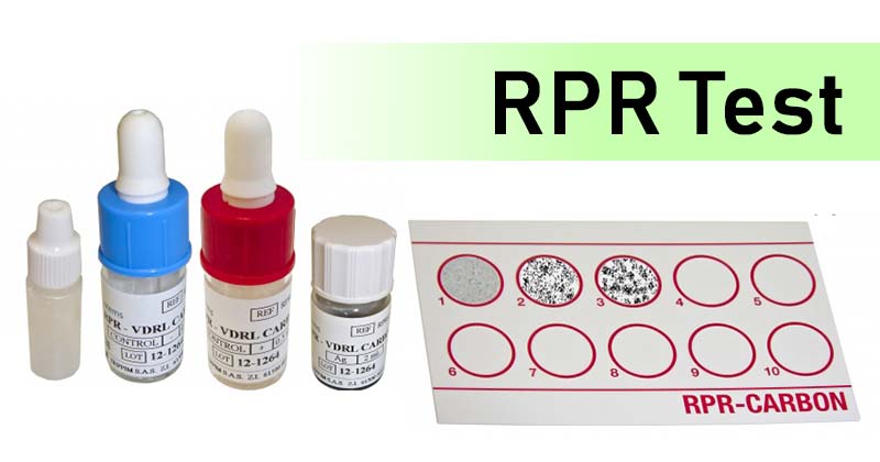 快速血浆里根(RPR)试验