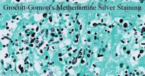 grocottgomori的Methenamine Silver染色