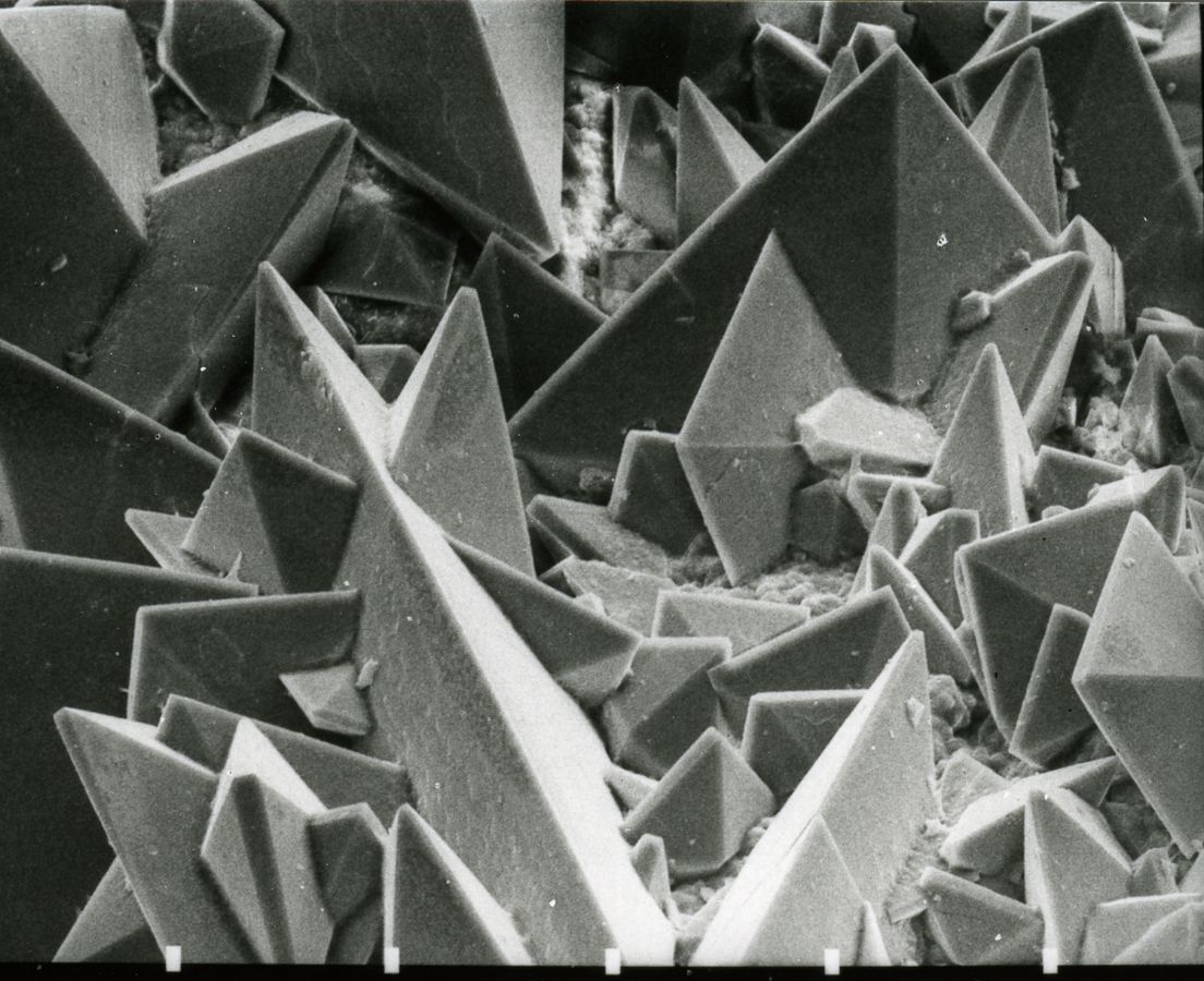 扫描电子显微照片肾结石表面显示出从石材的无定形中心部分出现的楔形晶体（草酸钙二水合物）的四方晶体