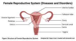 女性生殖系统的疾病和失调