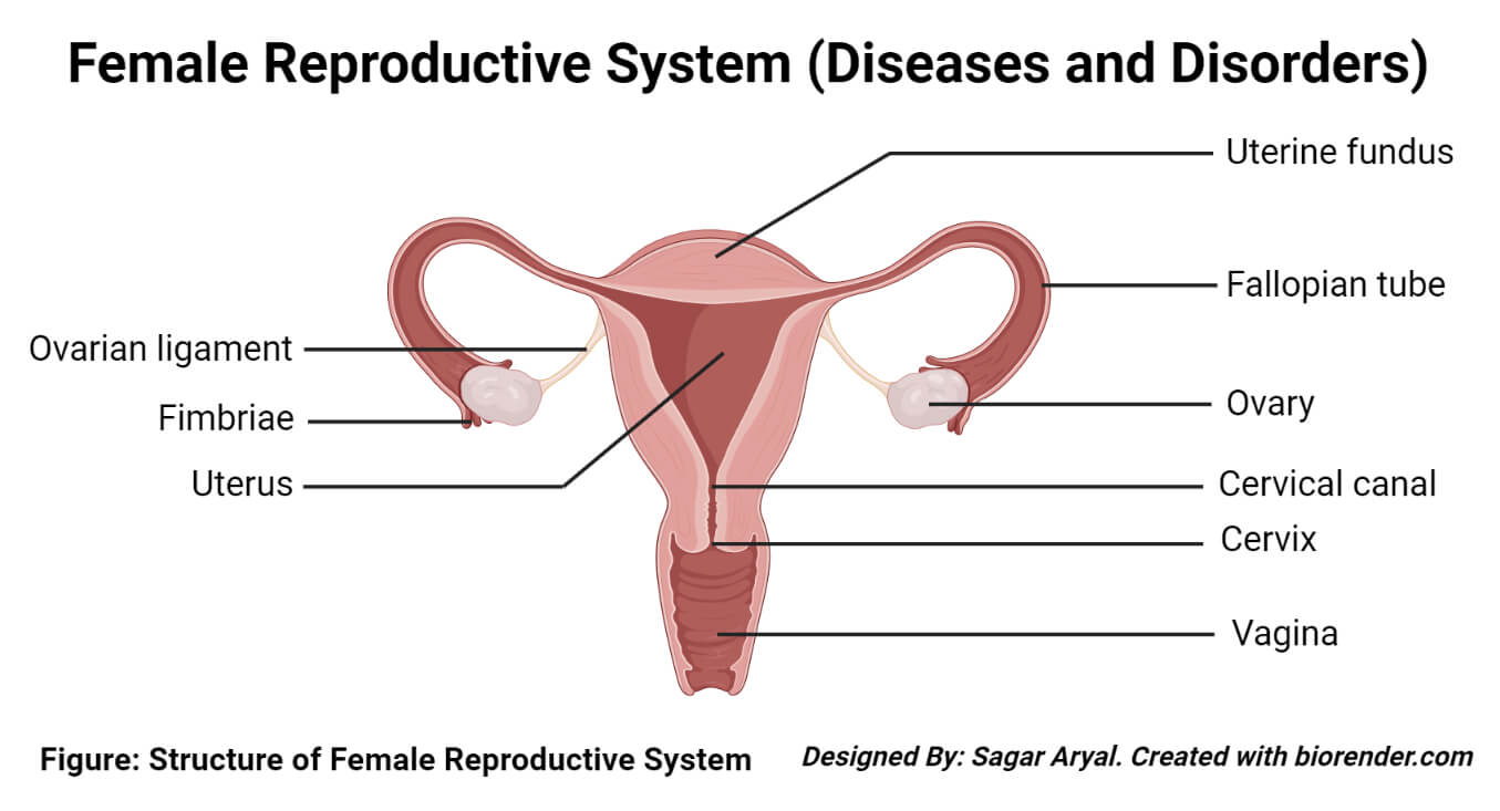 女性生殖系统疾病