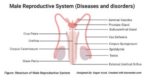 男性生殖系统的疾病和疾病