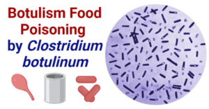 肉毒杆菌中毒由肉毒杆菌引起的食物中毒