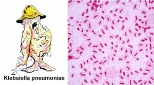 Habitat and Morphology of Klebsiella pneumoniae