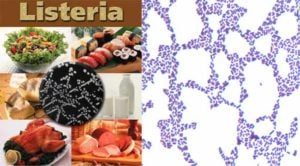 Habitat and Morphology of Listeria monocytogenes