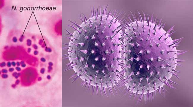 淋病奈瑟菌的生境和形态