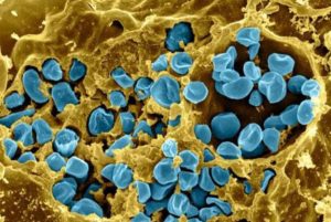土拉菌病的发病机制与临床表现