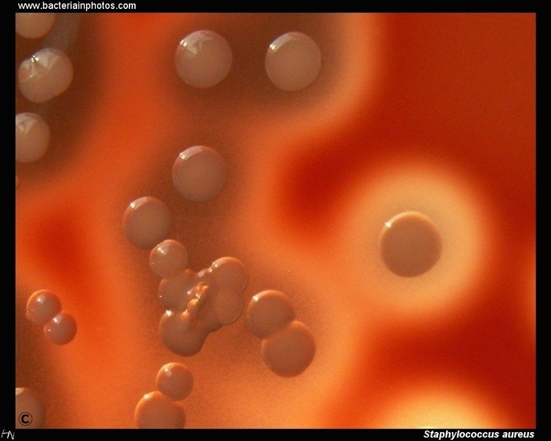 金黄色葡萄球菌在血琼脂上的菌落，beta溶血