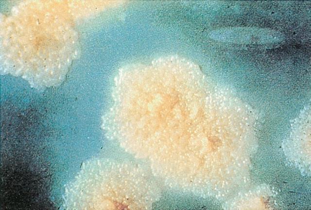 结核分枝杆菌的菌落形态，培养基8周后结核病·詹森琼脂