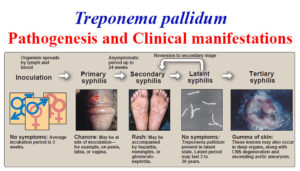Treponema Pallidum的发病机制与临床表现