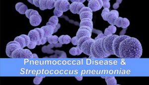 肺炎链球菌的毒力因子，发病机制和临床表现
