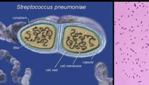 肺炎链球菌的实验室诊断、治疗和预防