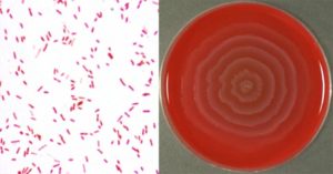 奇异变形杆菌的生化试验