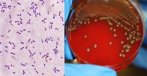 Biochemical Test of Streptococcus pneumoniae