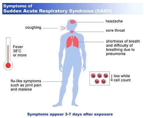SARS的临床表现