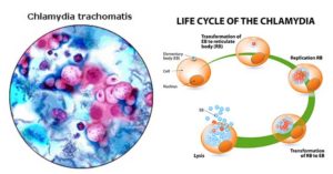 Pathogenesis and Clinical Manifestations of Chlamydia trachomatis