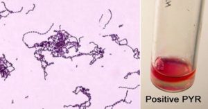 化脓性链球菌的生化检验