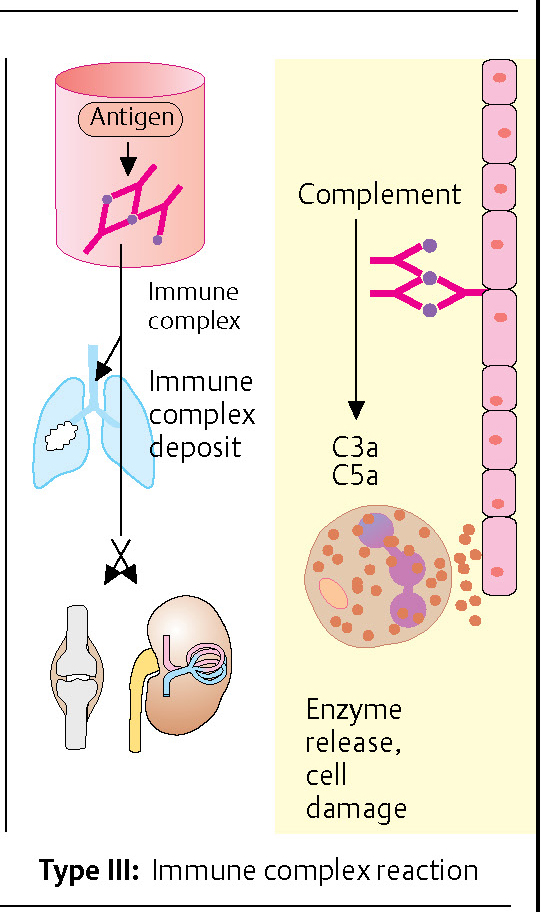 III型免疫复合体介导的反应
