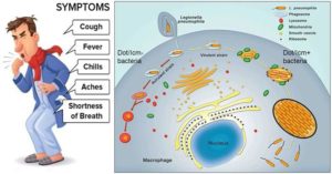 嗜肺军团菌的毒力因素、发病机制及临床表现