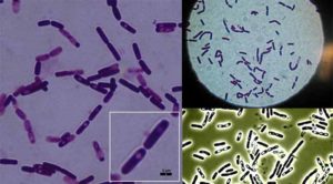 蜡样芽孢杆菌的生化试验