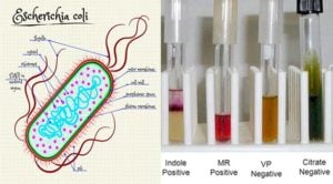 大肠杆菌(e.c oli)生化试验