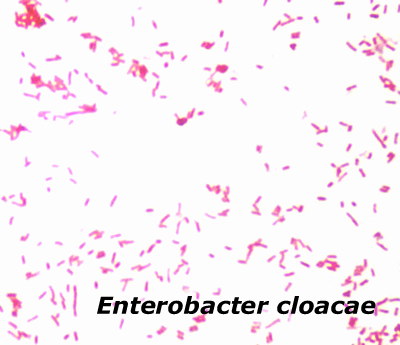 肠杆菌克洛拉·克染色