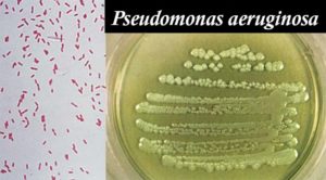 铜绿假单胞菌的生化检测