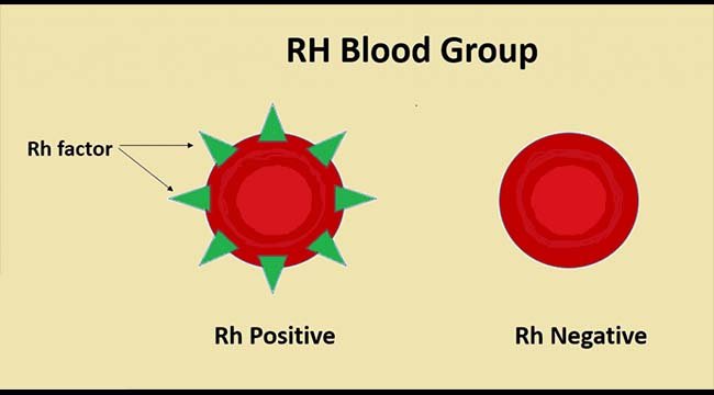 RH血型系统