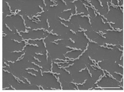 扫描电子显微照片的螺旋形状和跳跃曲杆菌的鞭毛