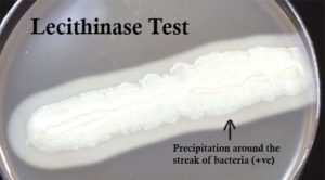 Result Interpretation of Lecithinase Test