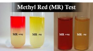 Result Interpretation of Methyl Red (MR) Test