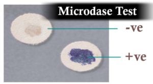 Microdase(修饰氧化酶)试验结果解释