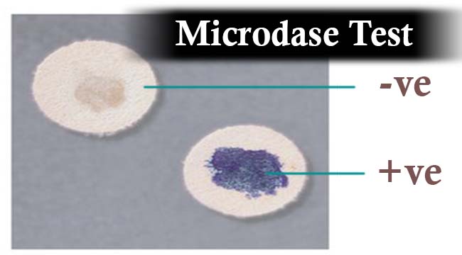 Microdase（改良氧化酶）试验结果解释