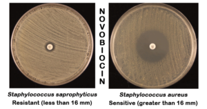 Result Interpretation of Novobiocin Susceptibility Test