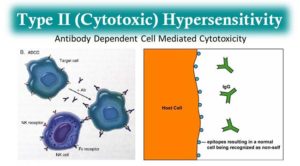II型（细胞毒性）超敏反应机制和实例