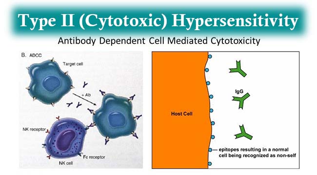 II型(细胞毒性)超敏反应-机制和例子