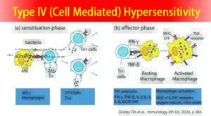 Type IV (Cell Mediated) Hypersensitivity- Mechanism and Examples