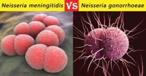 Neisseria Meningitidis和Neisseria Gonorrhoeae之间的差异