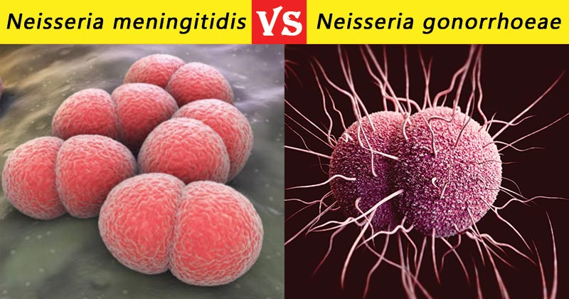 脑膜炎奈瑟菌与淋病奈瑟菌的区别