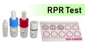 快速等离子体射回（RPR）测试