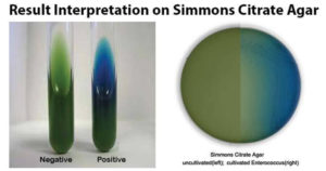 西蒙斯柠檬酸脂琼脂实验结果的解释