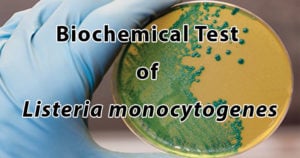 histeria单核细胞增生的生物化学测试