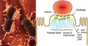 肠寄生大肠杆菌（EPEC）