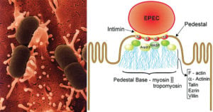 Enteropathogenic Escherichia coli (EPEC)