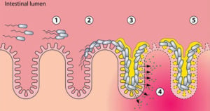 Stages of pathogenesis of EAEC