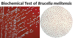 Brucella melitensis的生化试验