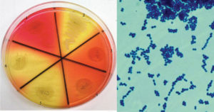 粪肠球菌的生化试验