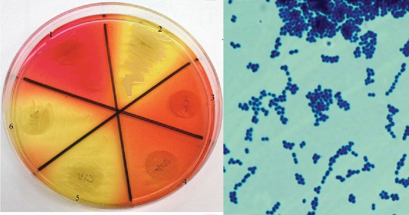 粪肠球菌生化试验