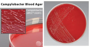 Campylobacter血液琼脂（CVA）